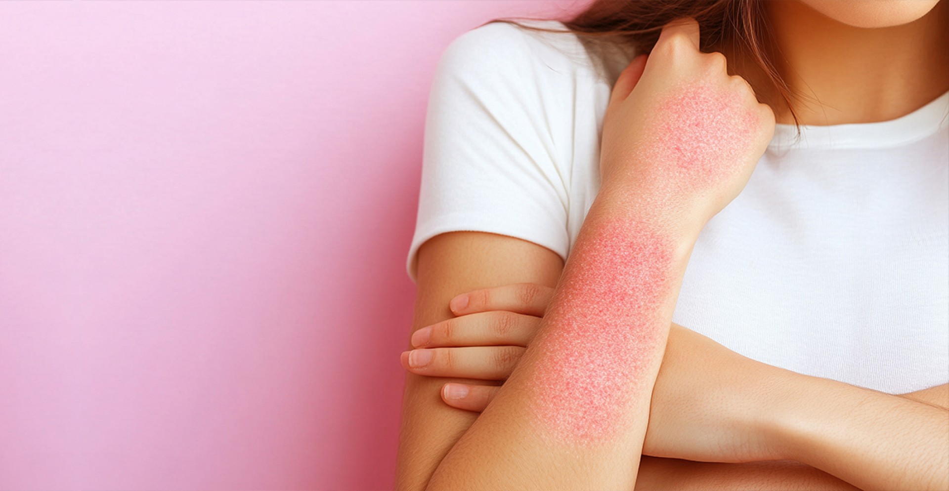 Ξηρότητα, έκζεμα, κοκκινίλες; Δες τι κάνει το κρύο στο δέρμα σου!